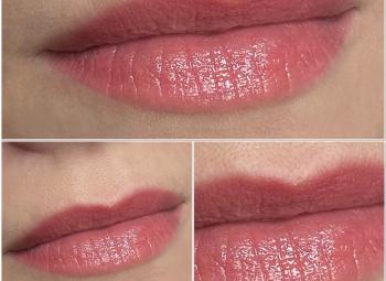 "Natural lip"