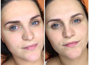 Microblading po procedūros/sugijus