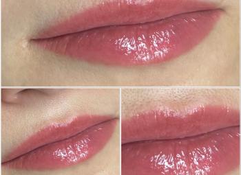 "Natural lip"