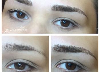 Microblading
